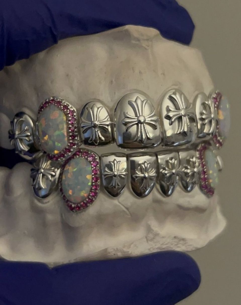 Opal and Ruby Custom Inlay