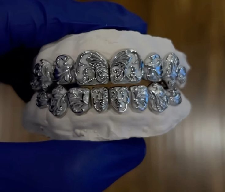 Baroque Filigree Full Set