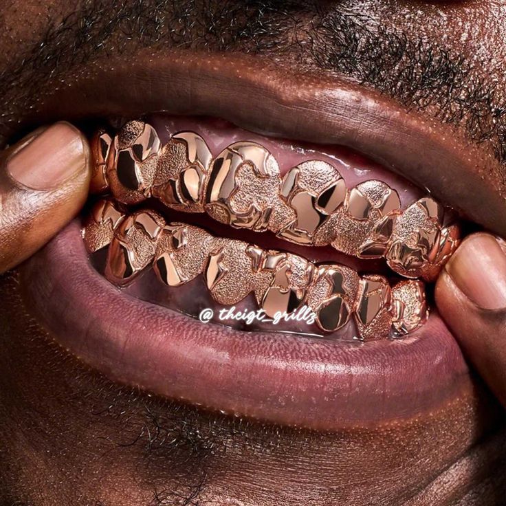 Rose Gold Nugget Set Worn